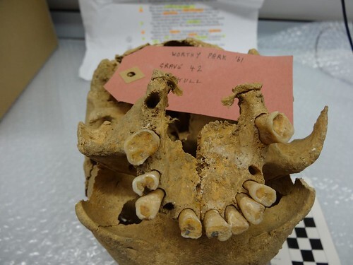 medievalteeth