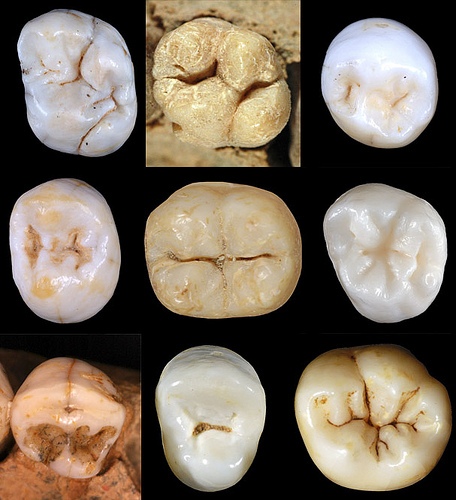 dentition