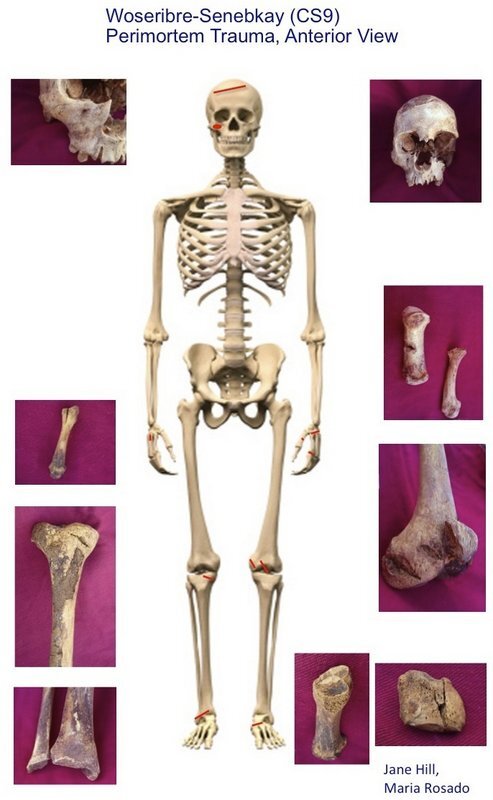 senekbayfig3