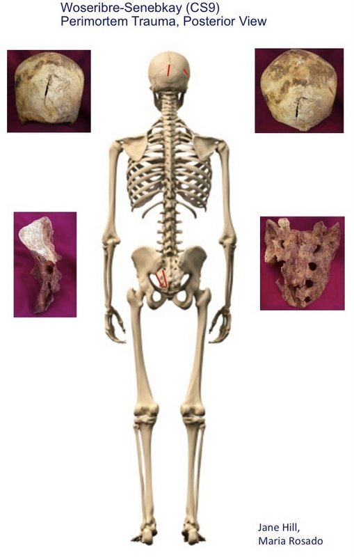 senekbayfig4