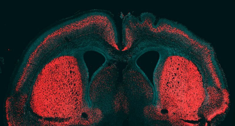 cerebralcortexmouse