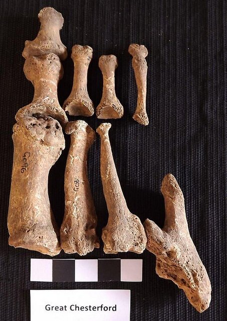chesterfordtoebones