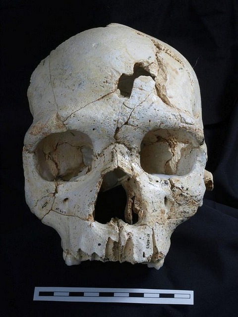 cranium17