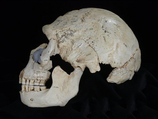 huesospic5