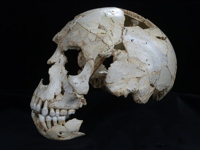 huesospic4