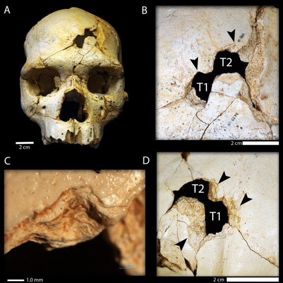 huesospic8
