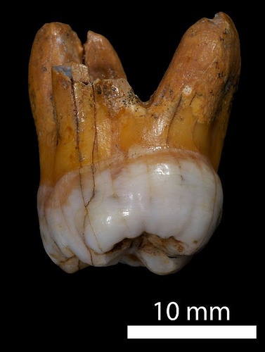 denisovabone3