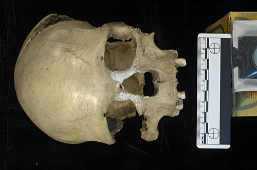 basqueskull