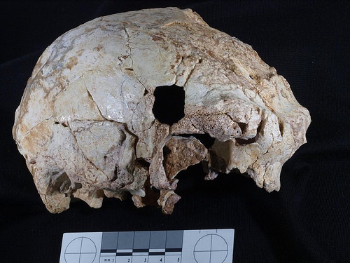 cranium1