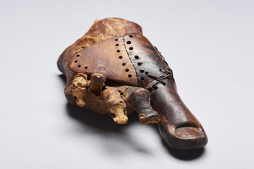 toe