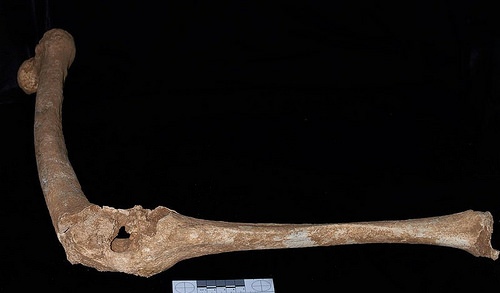 philipbones